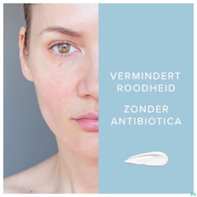 Dermalex a/roodheid creme 30g-5