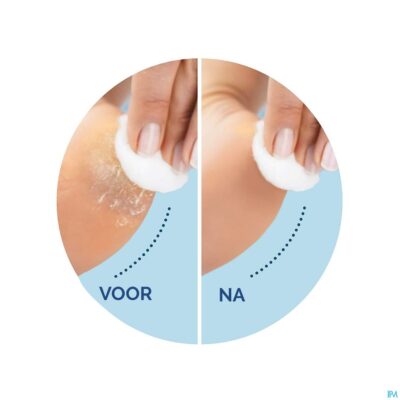 Scholl velvet smooth voetvijl el.+exfol. dh blauw-5